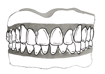 Teeth diagram